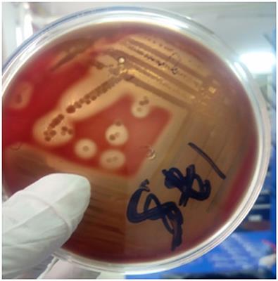 Occurrence, associated risk factors and antimicrobial resistance patterns of Staphylococcus aureus and methicillin resistant S. aureus from foods of bovine origin in Dessie and Kombolcha towns, Ethiopia